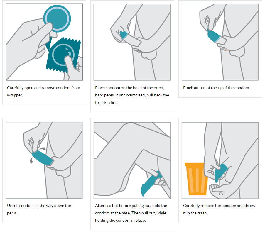 infographic depicting how to put on a condom