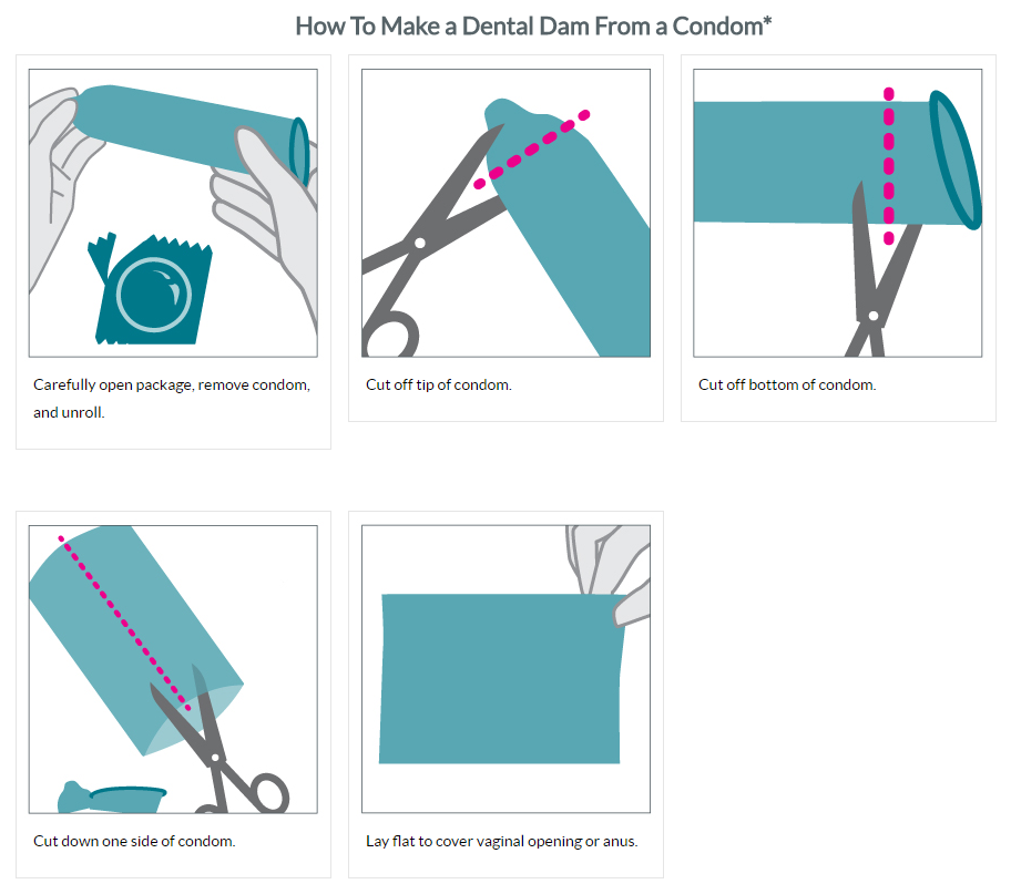 infographic depicting how to create an external condom